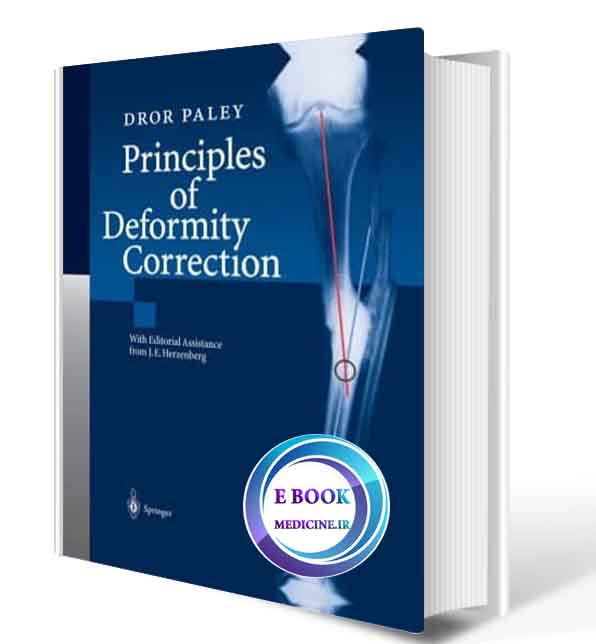 دانلود کتاب Principles of Deformity Correction  (ORIGINAL PDF)